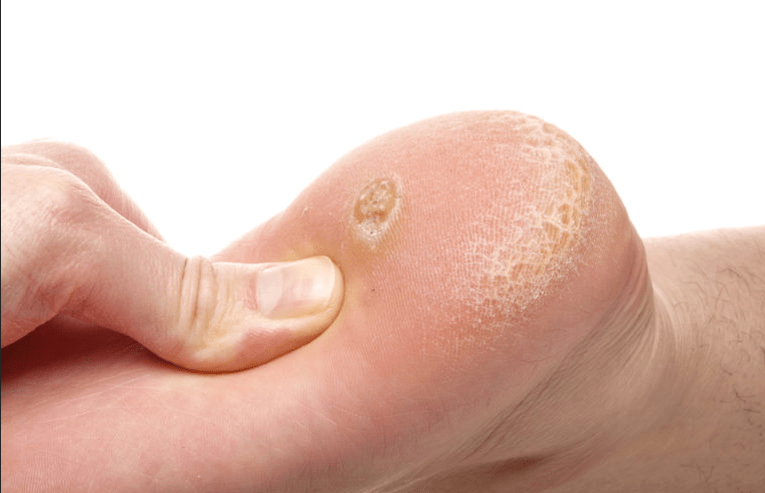 Wart sociale