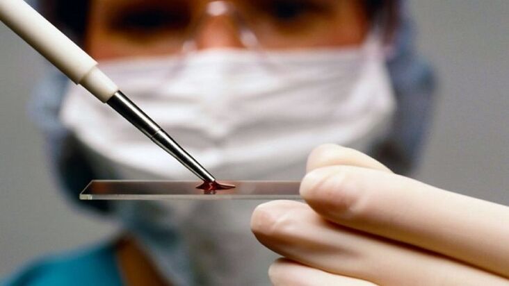 Diagnosi del papillomavirus umano